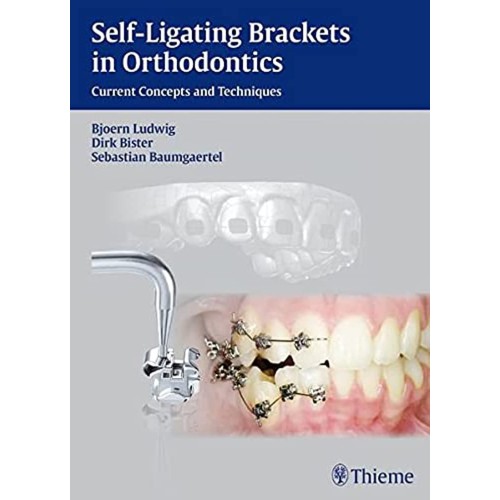 SELF LIGATING BRACKETS IN ORTHODONTICS