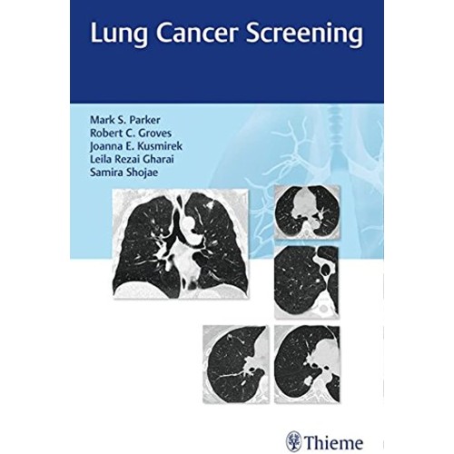 Lung Cancer Screening 1st Edition