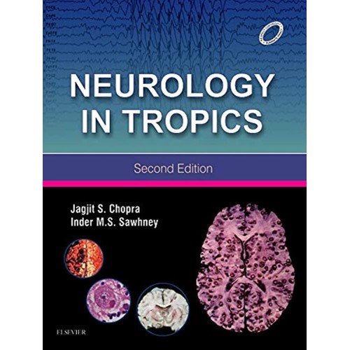 Tropics in Neurology - 2E