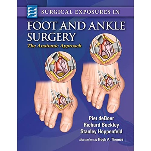 Surgical Exposures in Foot & Ankle Surgery - ...