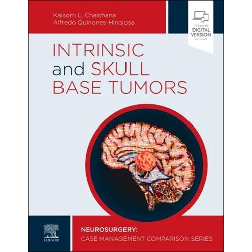 Intrinsic and Skull Base Tumors: Case Comparison Series -1E