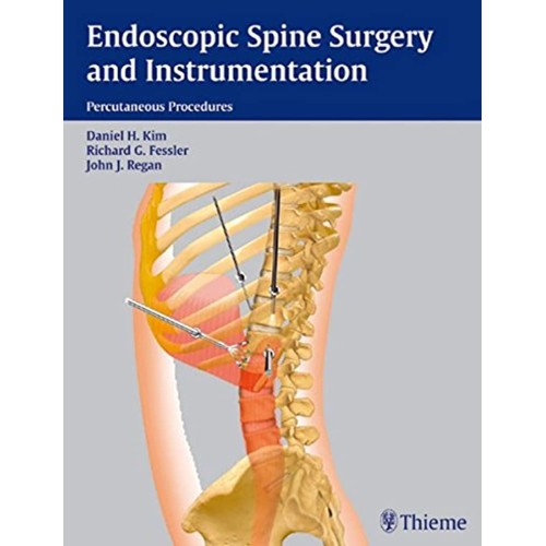 Endoscopic Spine Surgery and Instrumentation