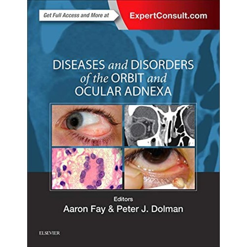 Diseases and Disorders of the Orbit and Ocular Adnexa: Expert Consult - Online and Print - 1E