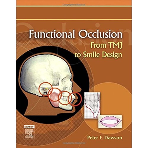 Functional Occlusion - 1E