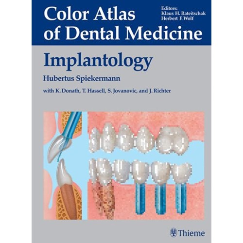 Color Atlas of Dental Medicine Implantology