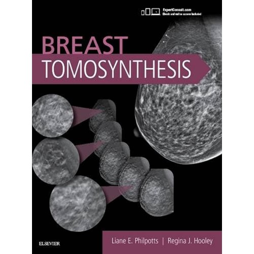 Breast Tomosynthesis -1E