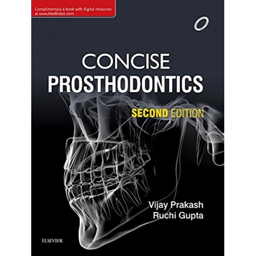 Concise Prosthodontics - 2E