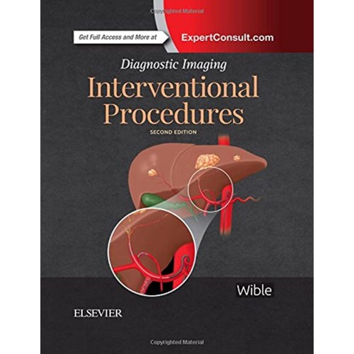 Diagnostic Imaging: Interventional Procedures - 2E