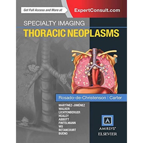 Specialty Imaging: Thoracic Neoplasms