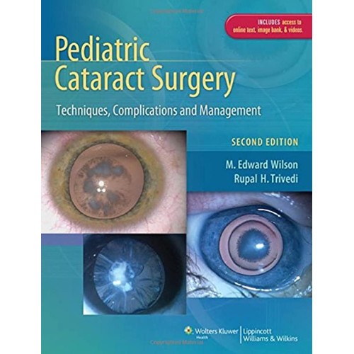 Pediatric Cataract Surgery - 2E