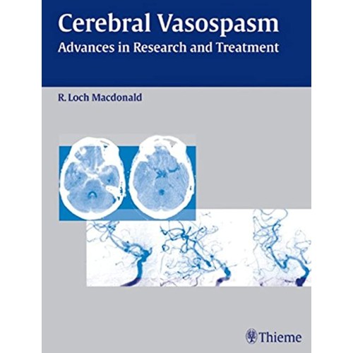 Cerebral Vasospasm