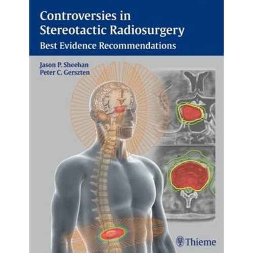 Controversies in Stereotactic Radiosurgery