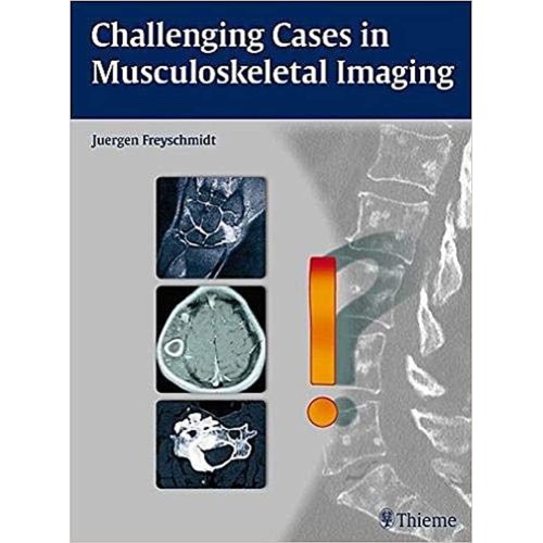 Challenging Cases in Musculoskeletal Imaging