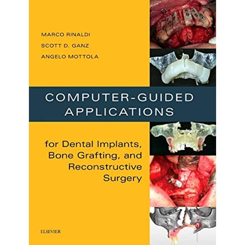 Computer-Guided Applications for Dental Implants, Bone Grafting, and Reconstructive Surgery (adapted translation)