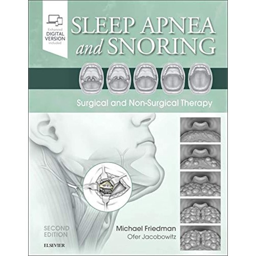 Sleep Apnea and Snoring -2E