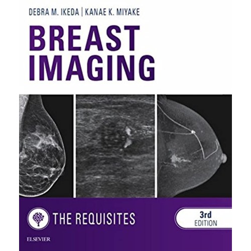 Breast Imaging: The Requisites