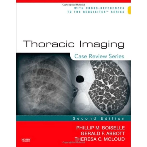 Thoracic Imaging: Case Review 2/e