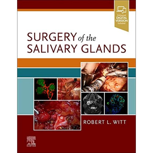 Surgery of the Salivary Glands-E