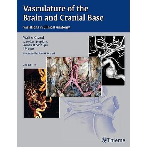 Vasculature of the Brain and Cranial Base 2nd Edition