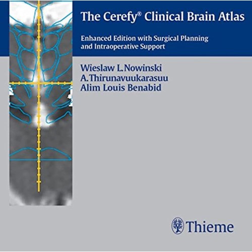 The Cerefy Clinical Brain Atlas/CD-ROM 2nd Ed...