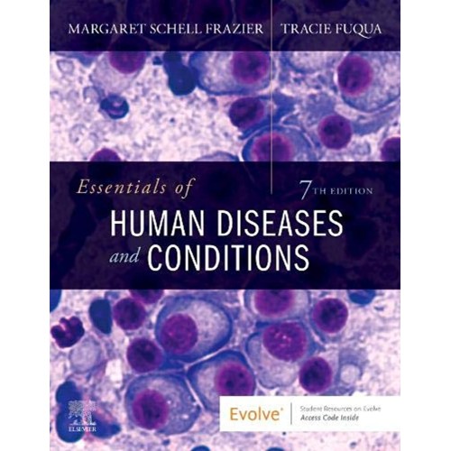 Essentials of Human Diseases and Conditions-7E