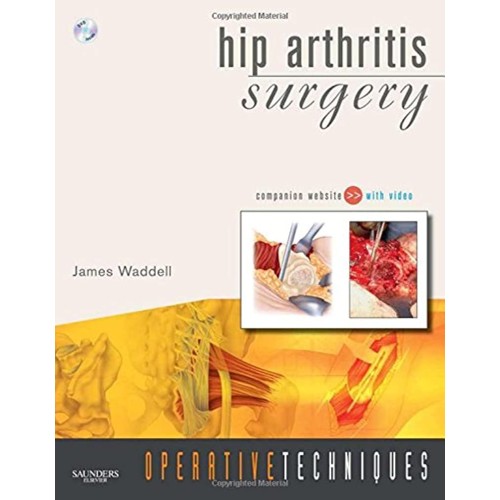 Operative Techniques- Hip Arthritis Surgery- Book, Website& DVD-1E