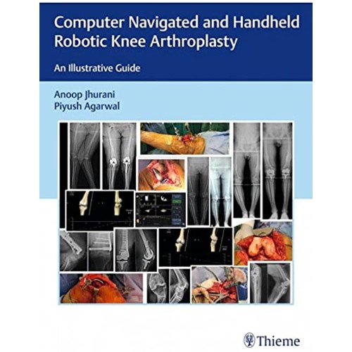 Computer Navigated and Hand Held Robotic Knee Arthroplasty: An Illustrative Guide, 1/e