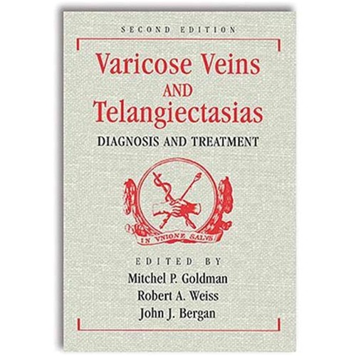 Varicose Veins and Telangiectasias: Diagnosis...