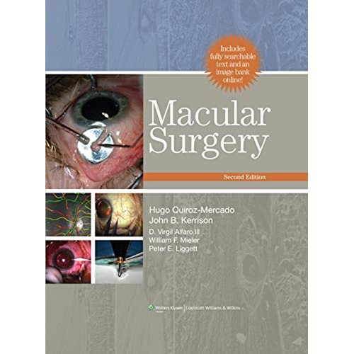 Macular Surgery 2/e