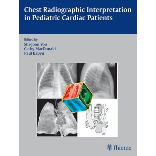 CHEST RADIOGRAPHIC INTERPRETATION IN PEDIATRI...