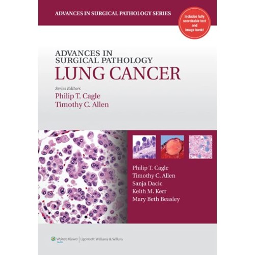 Advanced Surgical Pathology Lung Cancer - 1E