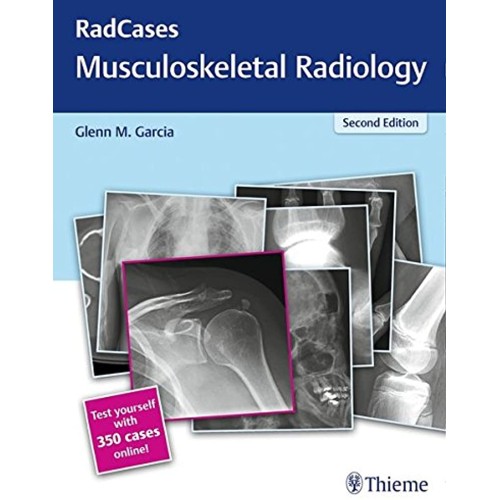 Radcases Musculoskeletal Radiology 2nd Edition