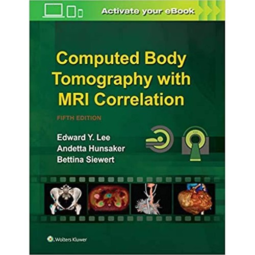 Computed Body Tomography with MRI Correlation - 5E