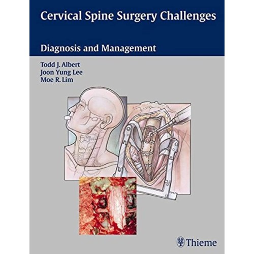 Cervical Spine Surgery Challenges