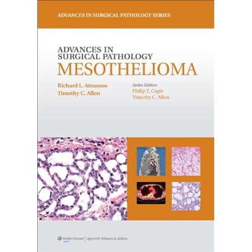 Advances in Surgical Pathology: Mesothelioma - 1E