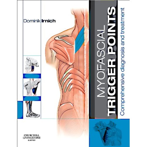 Myofascial Trigger Points-1E