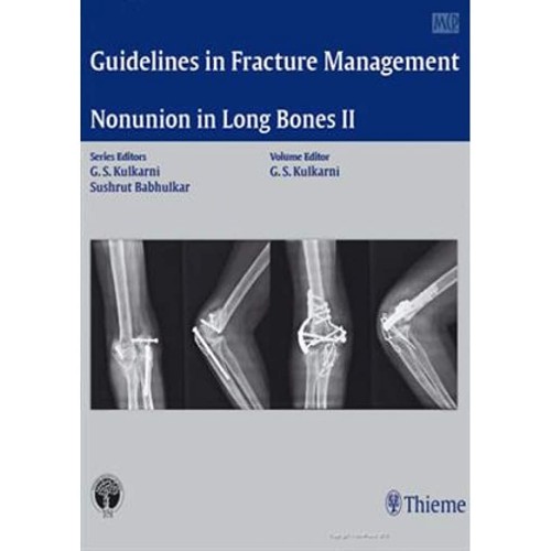 Nonunion in Long Bones-Part II