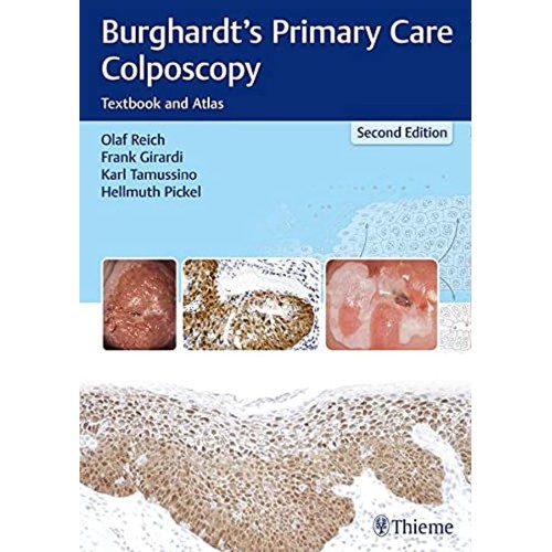 Burghardt's Primary Care Colposcopy 2nd Edition