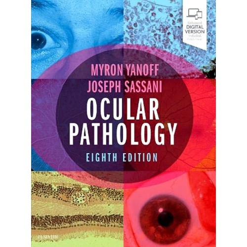 Ocular Pathology -8E