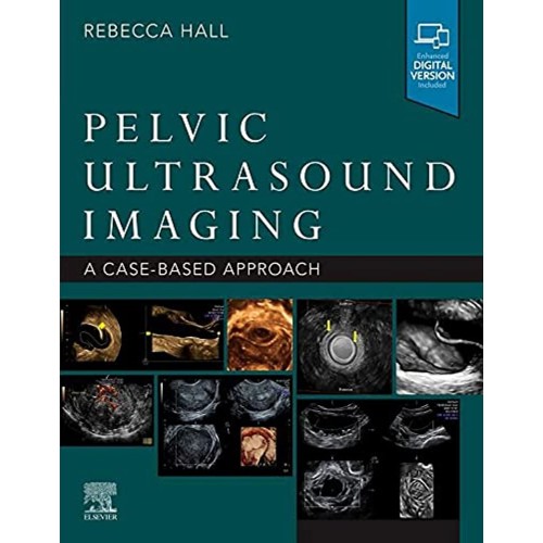 Pelvic Ultrasound Imaging-1E