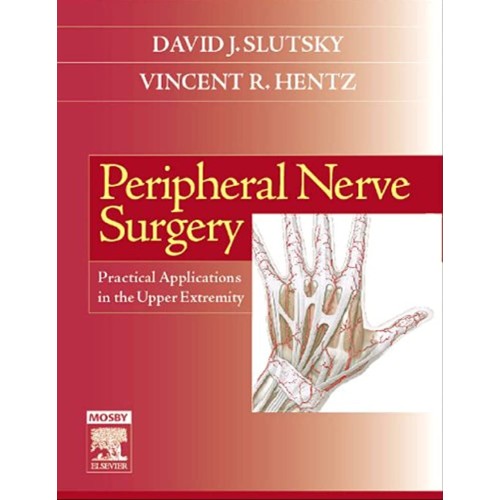 Peripheral Nerve Surgery