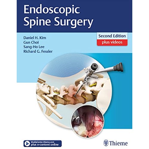 Endoscopic Spine Surgery 2nd Edition