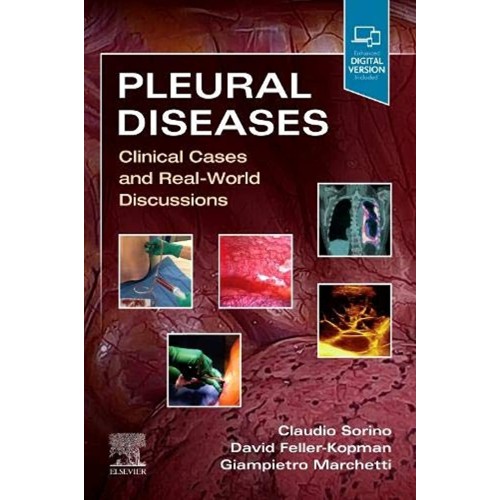 Pleural Diseases-1E