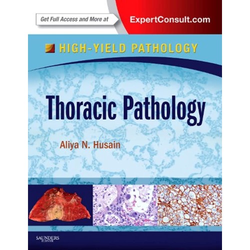 Thoracic Pathology: A Volume in the High Yield Pathology Seri