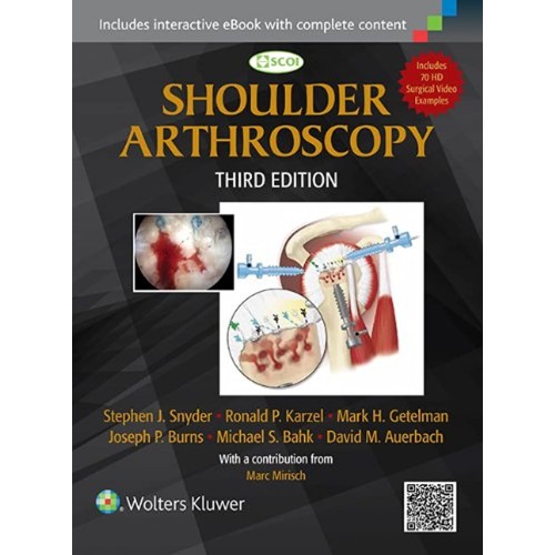 Shoulder Arthroscopy - 3E