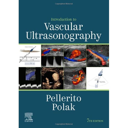 Introduction to Vascular Ultrasonography: Expert Consult - Online and Print - 7E