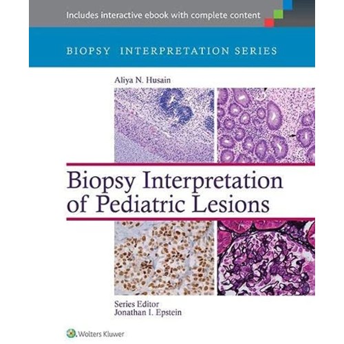 Biopsy Interpretation of Pediatric Lesions