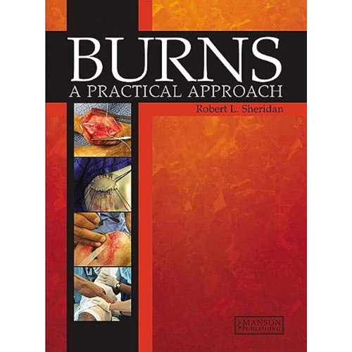 Burns - A Practical Approach 1st Edition