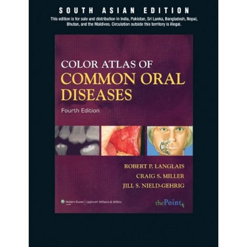 Color Atlas of Common Oral Dise 4/e