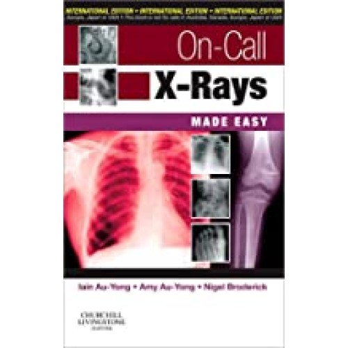 On-Call X-Rays Made Easy